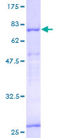 12.5% SDS-PAGE Stained with Coomassie Blue